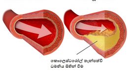 ඔබගේ කොලෙස්ටරෝල් මට්ටම අඩු කරගන්නේ කොහොමද